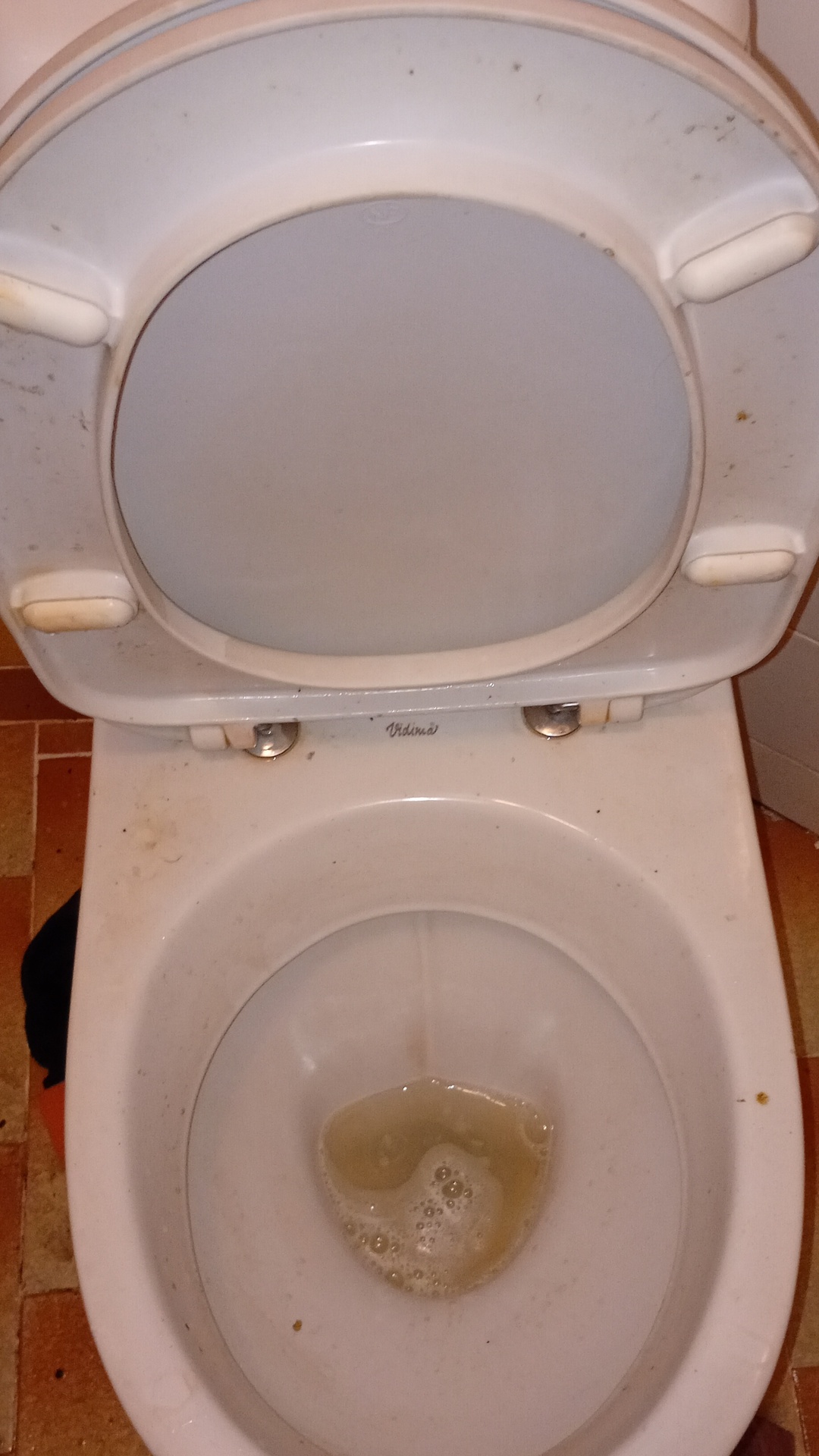 Before photo for Deep Cleaning